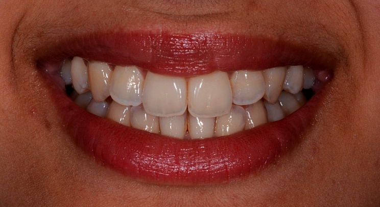 Case 2 Before