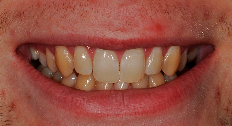 Case 5 Before
