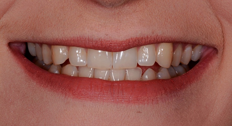Case 6 Before