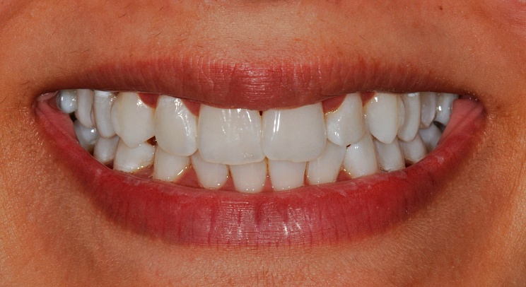 Case 7 after