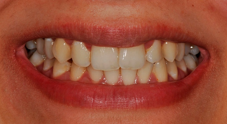 Case 7 before